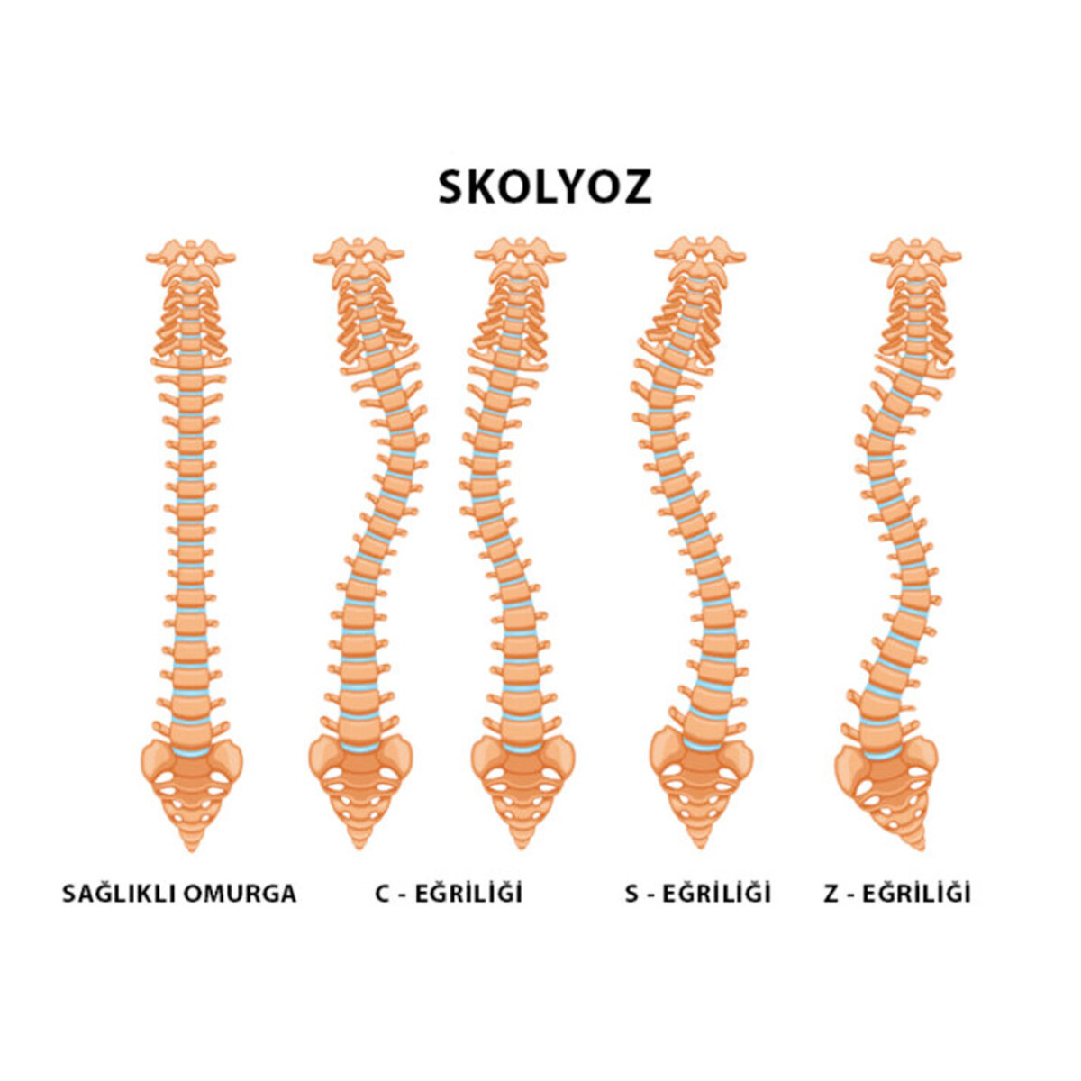 Skolyoz ve Manuel Terapi: Atlas Terapi ile Doğal Dengeyi Sağlayın